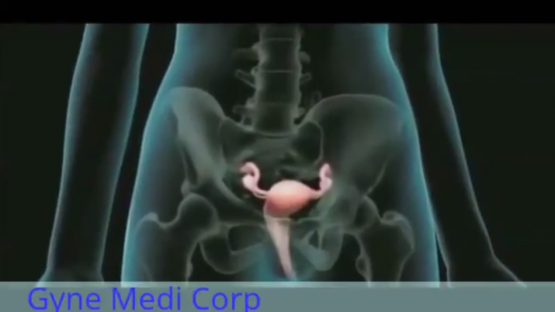 video11