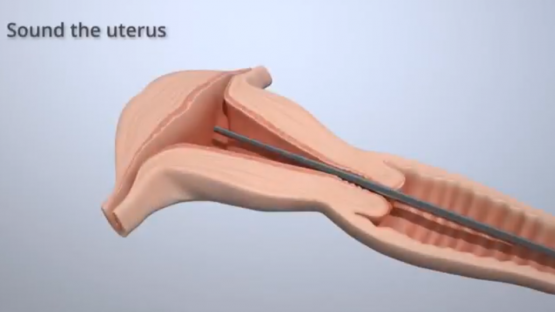 video12