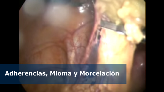 video4