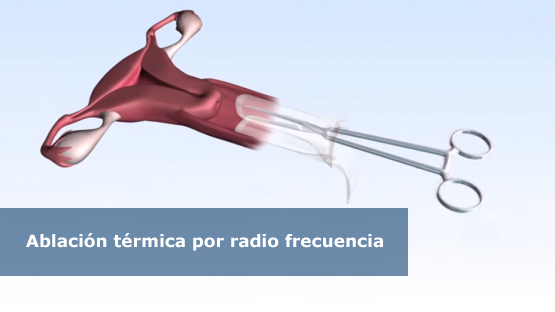 radio_frecuencia